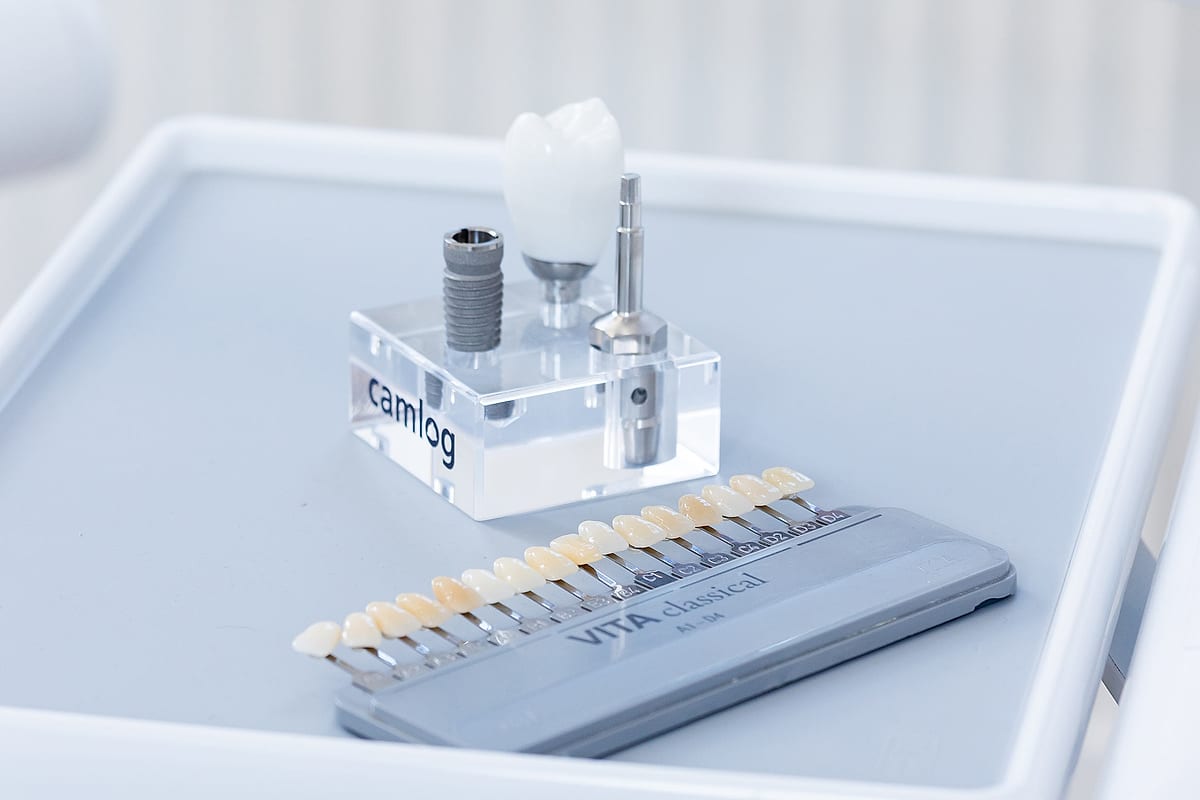 Implantatgetragene Versorgung auf Modell