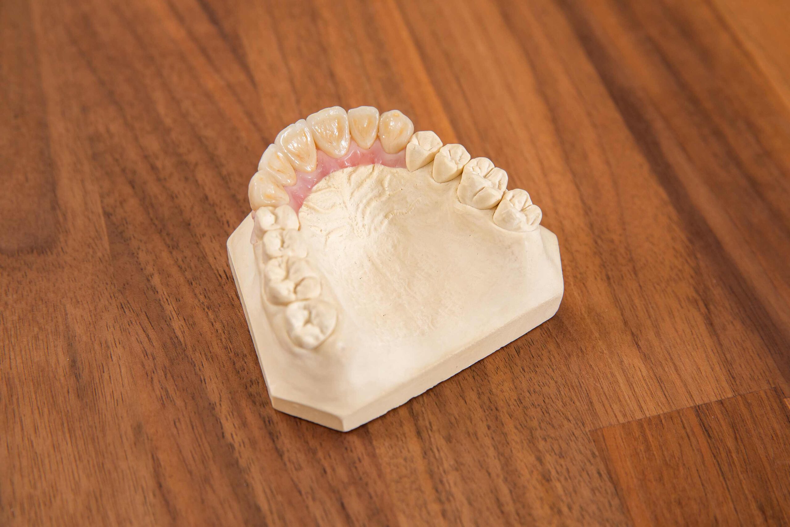 art-of-dent-vollkeramik