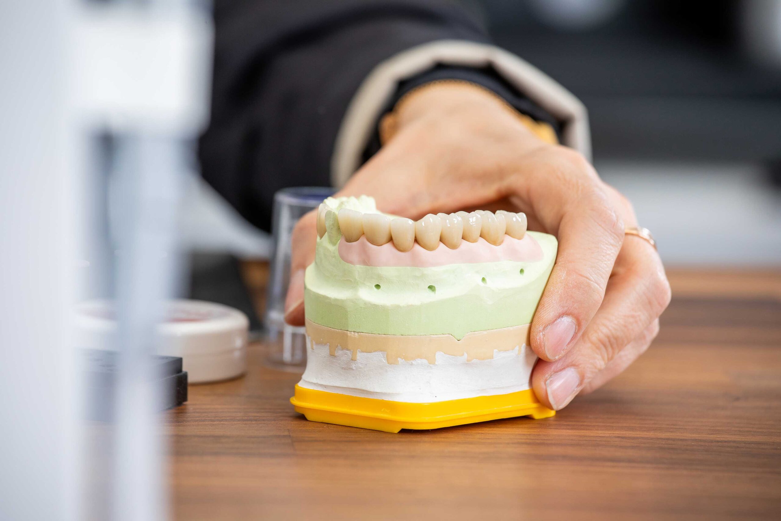 kronen-bruecken-art-of-dent-zahnarzt-potsdam